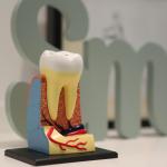 Matching Rotary Files with Gutta Percha Points: Why Size, Taper, and Compatibility Are Key to Root Canal Success